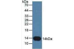Detection of CSTB in Rat Placenta Tissue using Monoclonal Antibody to Cystatin B (CSTB) (CSTB anticorps  (AA 2-98))