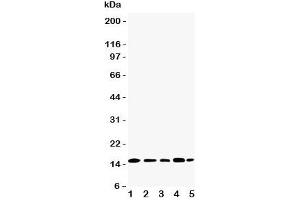 Western blot testing of TIA-1 antibody and Lane 1:  Jurkat;  2: Raji;  3: CEM;  4: HT1080;  5: K562 cell lysate. (TIA1 anticorps  (N-Term))