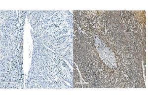 IHC analysis of OB Cadherin/CDH11 using anti-OB Cadherin/CDH11 antibody (ABIN5518978). (OB Cadherin anticorps  (AA 55-293))