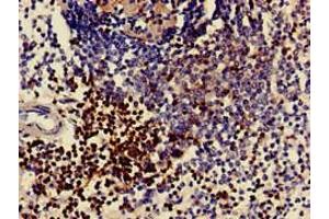 Immunohistochemistry of paraffin-embedded human spleen tissue using ABIN7171382 at dilution of 1:100