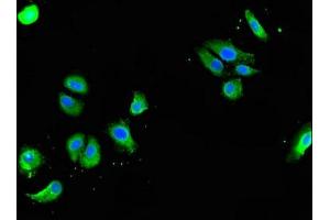 Immunofluorescent analysis of HepG2 cells using ABIN7154324 at dilution of 1:100 and Alexa Fluor 488-congugated AffiniPure Goat Anti-Rabbit IgG(H+L)
