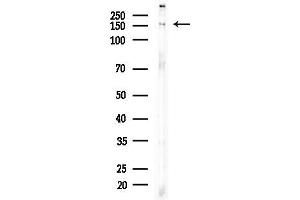 Western blot analysis of lysates from EC304 cells, using Phospho-TBC1 (Ser237) Antibody at 1/1000 dilution.