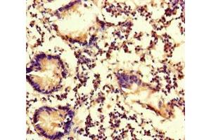 Immunohistochemistry of paraffin-embedded human appendix tissue using ABIN7174949 at dilution of 1:100