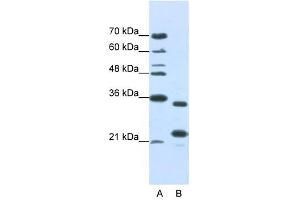 ALKBH8 antibody used at 1 ug/ml to detect target protein. (ALKBH8 anticorps)