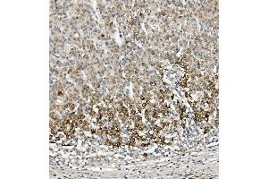 IHC analysis of Sprouty 4/Spry-4/SPRY4 using anti-Sprouty 4/Spry-4/SPRY4 antibody (ABIN7599232).