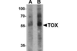 Western blot analysis of TOX in human colon tissue lysate with TOX antibody at (A) 1 and (B) 2 µg/mL. (TOX anticorps  (N-Term))