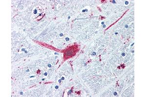 Anti-DRD3 / Dopamine Receptor D3 antibody IHC of human brain, globus pallidus.