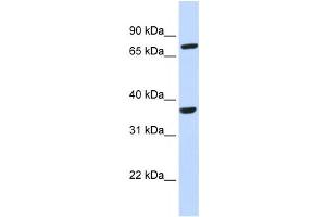 Western Blotting (WB) image for anti-Chemokine (C-C Motif) Receptor-Like 2 (CCRL2) antibody (ABIN2458062) (CCRL2 anticorps)