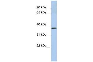 Calreticulin 3 antibody used at 1 ug/ml to detect target protein. (Calreticulin 3 anticorps  (N-Term))