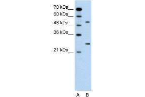 WB Suggested Anti-CACNB1 Antibody Titration:  0. (CACNB1 anticorps  (Middle Region))