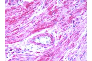 Human Prostate: Formalin-Fixed, Paraffin-Embedded (FFPE)