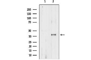Western blot analysis of lysates from heat-shock treated HepG2 cells, using Phospho-AMPK beta-1(Ser181) Antibody.