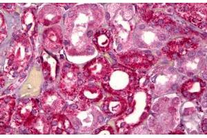 Anti-GHRHR antibody IHC staining of human kidney, tubules. (GHRHR anticorps  (AA 351-400))