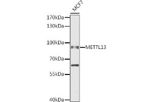 Western blot analysis of extracts of MCF7 cells, using METTL13 antibody (ABIN6131842, ABIN6143755, ABIN6143757 and ABIN6216265) at 1:1000 dilution. (METTL13 anticorps  (AA 430-699))