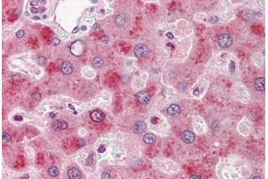 Human Liver: Formalin-Fixed, Paraffin-Embedded (FFPE) (Coagulation Factor IX anticorps)