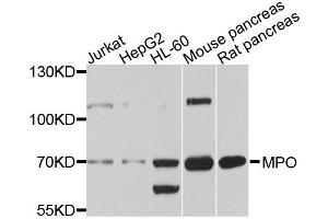 Western blot analysis of extracts of various cell lines, using MPO antibody (ABIN4904410) at 1:1000 dilution.