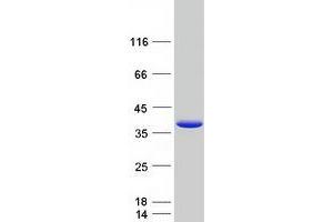Validation with Western Blot