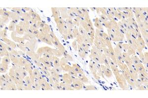 Detection of BCAT1 in Human Cardiac Muscle Tissue using Polyclonal Antibody to Branched Chain Aminotransferase 1, Cytosolic (BCAT1) (BCAT1 anticorps  (AA 174-386))