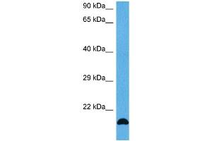 Host:  Mouse  Target Name:  FGF2  Sample Tissue:  Mouse Skeletal Muscle  Antibody Dilution:  1ug/ml (FGF2 anticorps  (Middle Region))