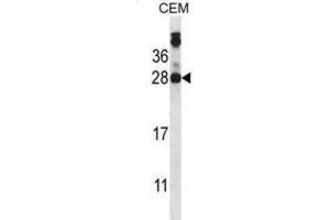 Western Blotting (WB) image for anti-Junctional Adhesion Molecule 2 (JAM2) antibody (ABIN2997813) (JAM2 anticorps)