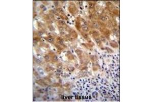FAH Antibody (N-term) (ABIN655906 and ABIN2845306) immunohistochemistry analysis in formalin fixed and paraffin embedded human liver tissue followed by peroxidase conjugation of the secondary antibody and DAB staining. (FAH anticorps  (N-Term))