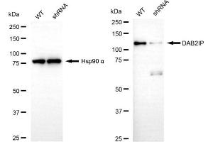 Western blotting analysis using DAB2IP antibody (ABIN7798271). (DAB2IP anticorps)