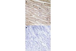 Immunohistochemical staining (Formalin-fixed paraffin-embedded sections) of human heart tissue with PEA15 (phospho S104) polyclonal antibody  without blocking peptide (A) or preincubated with blocking peptide (B) under 1:50-1:100 dilution. (PEA15 anticorps  (pSer104))