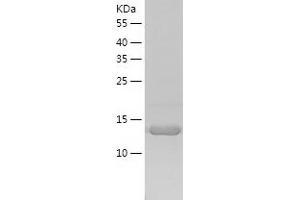 Western Blotting (WB) image for Peptidyl-tRNA Hydrolase 2 (PTRH2) (AA 64-179) protein (His tag) (ABIN7124339)
