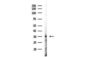 anti-Phosphotidylinositol Transfer Protein, beta (PITPNB) (C-Term) antibody