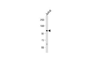 Anti-PRMT10 Antibody (N-term) at 1:1000 dilution + Jurkat whole cell lysate Lysates/proteins at 20 μg per lane. (PRMT10 anticorps  (N-Term))