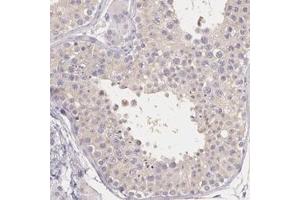 Immunohistochemical staining of human testis with KIAA1333 polyclonal antibody  shows weak cytoplasmic positivity in cells in seminiferus ducts at 1:200-1:500 dilution. (G2E3 anticorps)