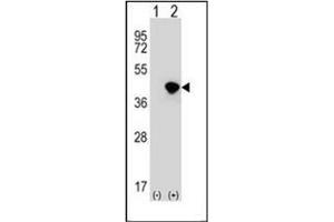 Western blot analysis of DFFA (arrow) using DFFA / ICAD Antibody (C-term) Cat. (DFFA anticorps  (C-Term))