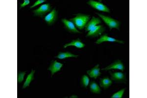 Immunofluorescence staining of Hela cells with ABIN7143995 at 1:66, counter-stained with DAPI. (AIMP1 anticorps  (AA 25-180))