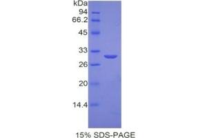 SDS-PAGE of Protein Standard from the Kit (Highly purified E. (ODC1 Kit ELISA)
