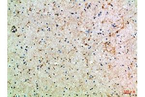Immunohistochemical analysis of paraffin-embedded Human-brain, antibody was diluted at 1:100
