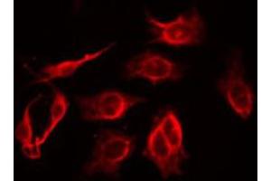 ABIN6274907 staining HuvEc by IF/ICC.