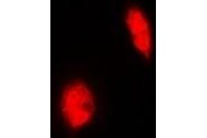Immunofluorescent analysis of ERG staining in Hela cells. (ERG anticorps)