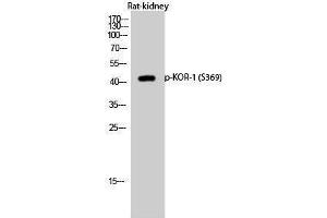 Western Blotting (WB) image for anti-Opioid Receptor, kappa 1 (OPRK1) (pSer369) antibody (ABIN3182199) (OPRK1 anticorps  (pSer369))