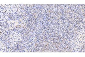 Detection of Hsp60 in Human Spleen Tissue using Polyclonal Antibody to Heat Shock Protein 60 (Hsp60)