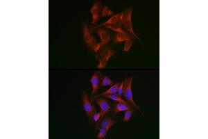 Immunofluorescence analysis of U2OS cells using STA Rabbit pAb (ABIN6128540, ABIN6148576, ABIN6148578 and ABIN6223670) at dilution of 1:50 (40x lens). (STAT5A anticorps  (AA 635-794))
