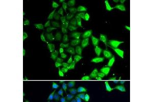 Immunofluorescence analysis of MCF-7 cells using MID1 Polyclonal Antibody (MID1 anticorps)