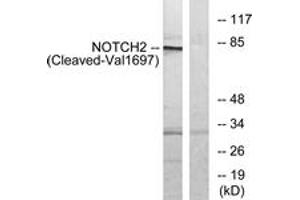 Western blot analysis of extracts from Jurkat cells, treated with etoposide 25uM 24h, using NOTCH2 (Cleaved-Val1697) Antibody. (NOTCH2 anticorps  (Cleaved-Val1697))