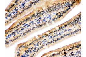 NIRF was detected in paraffin-embedded sections of mouse intestine tissues using rabbit anti- NIRF Antigen Affinity purified polyclonal antibody at 1 μg/mL.