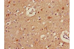 Immunohistochemistry of paraffin-embedded human brain tissue using ABIN7170921 at dilution of 1:100 (ALDH5A1 anticorps  (AA 48-535))