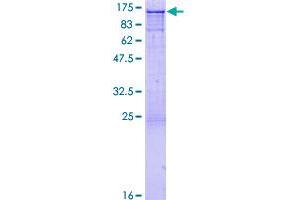 Image no. 1 for Cas-Br-M (Murine) Ecotropic Retroviral Transforming Sequence (CBL) (AA 1-906) protein (GST tag) (ABIN1348168)