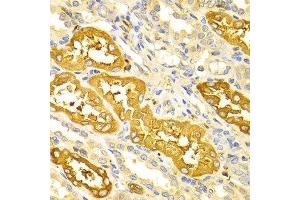 Immunohistochemistry of paraffin-embedded Human kidney using BIN1 antibody at dilution of 1:100 (x400 lens).