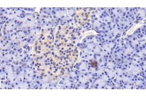 Detection of PIIINP in Human Pancreas Tissue using Polyclonal Antibody to Procollagen III N-Terminal Propeptide (PIIINP) (PIIINP anticorps)
