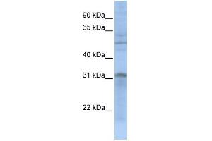 WB Suggested Anti-MTCH2 Antibody Titration: 0. (MTCH2 anticorps  (N-Term))