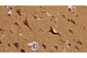 Immunohistochemistry of paraffin-embedded Human brain using MRPL39 Polyclonal Antibody at dilution of 1:45