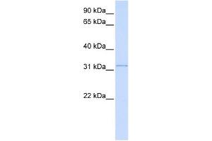 SUSD4 antibody used at 1 ug/ml to detect target protein. (SUSD4 anticorps  (N-Term))